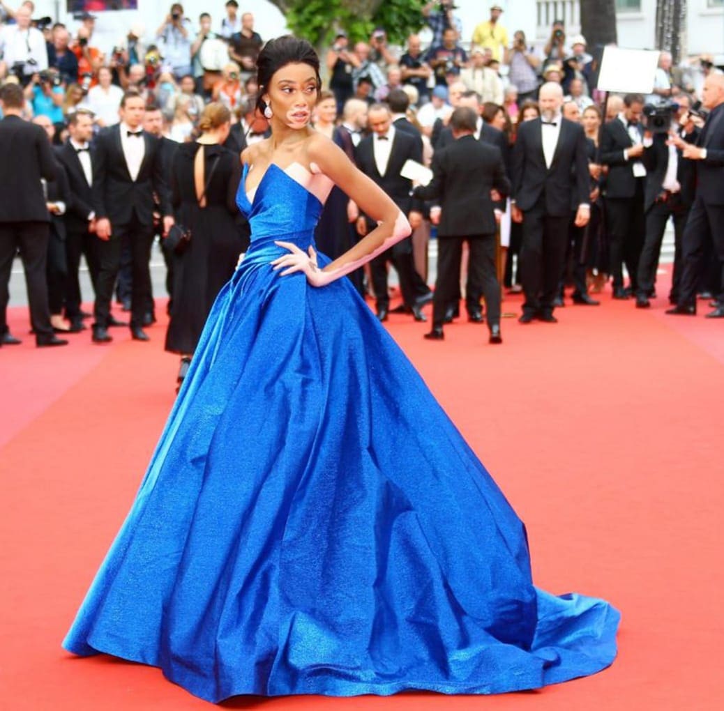 Winnie Harlow par Runway Magazine Winnie Harlow par Runway Magazine Festival du film de mode de Cannes 2017
